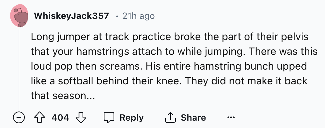 number - WhiskeyJack357 21h ago Long jumper at track practice broke the part of their pelvis that your hamstrings attach to while jumping. There was this loud pop then screams. His entire hamstring bunch upped a softball behind their knee. They did not ma